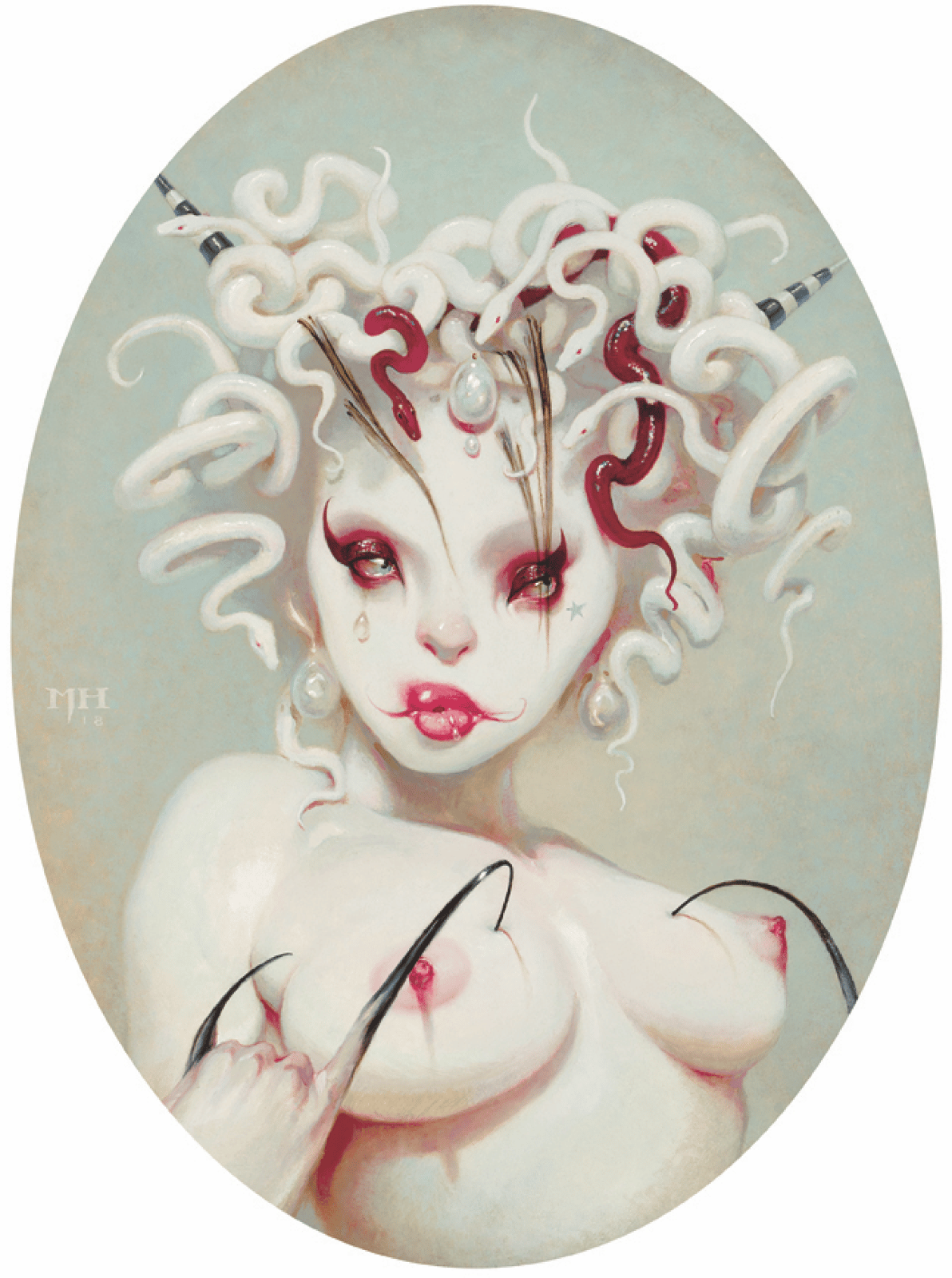 MEDUSA